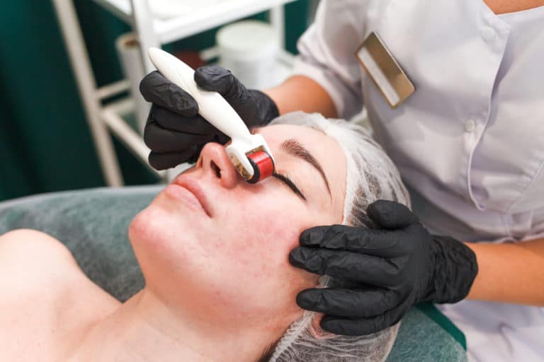 What to Put on Skin After Microneedling  – 6 Tips You Should Follow