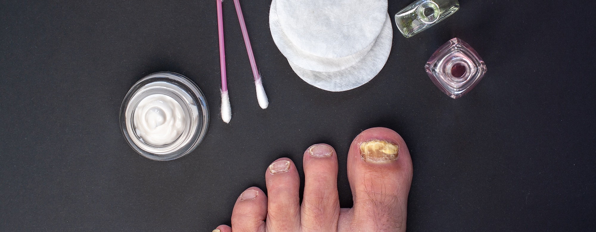 can I get a pedicure with toenail fungus feature