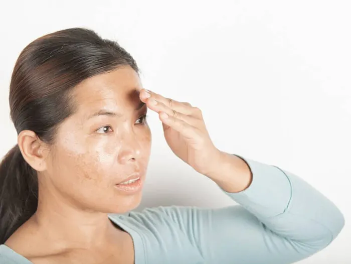 how-to-get-rid-of-oily-skin-permanently